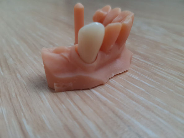 ree