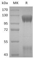 Recombinant Human IGF-I R (C-6His)