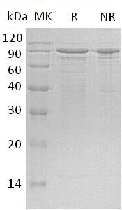 Recombinant Human Methyl-CpG-Binding Protein 2/MECP2 (C-6His)