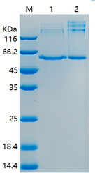 Recombinant Human Interferon regulatory factor 5/IRF5 (C-His)