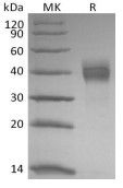 Recombinant Rhesus Macaque TROP-2 (C-6His)