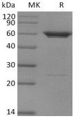 Recombinant Human PFKFB3 (N-6His)