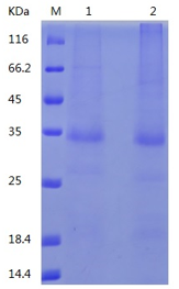 Recombinant Human Proteinase 3/Myeloblastin (C-His)