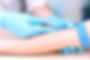 platelet function test preparation