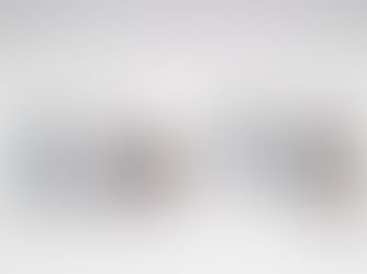 Ristocetin in platelet function testing