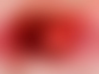 Beneath the Surface: Unraveling the Crucial Role of Platelets in Atherothrombosis