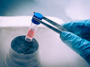 All about stem cell therapy