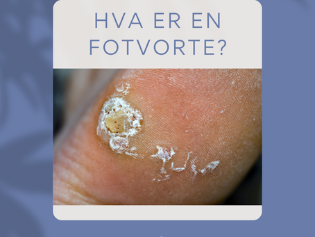 Hva er en fotvorte?