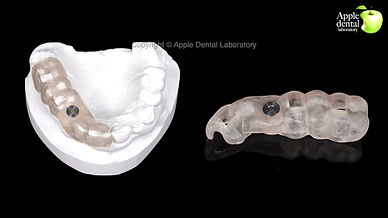 3D surgical guide