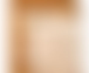 Item 153- Capa protetora para interruptor de tomada.