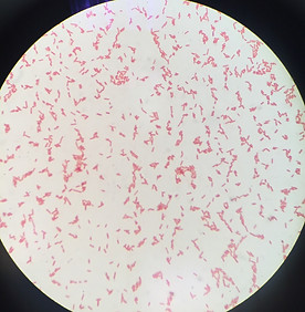 Gram Neg Bacilli.jpg
