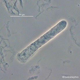 Hyaline Casts.jpg