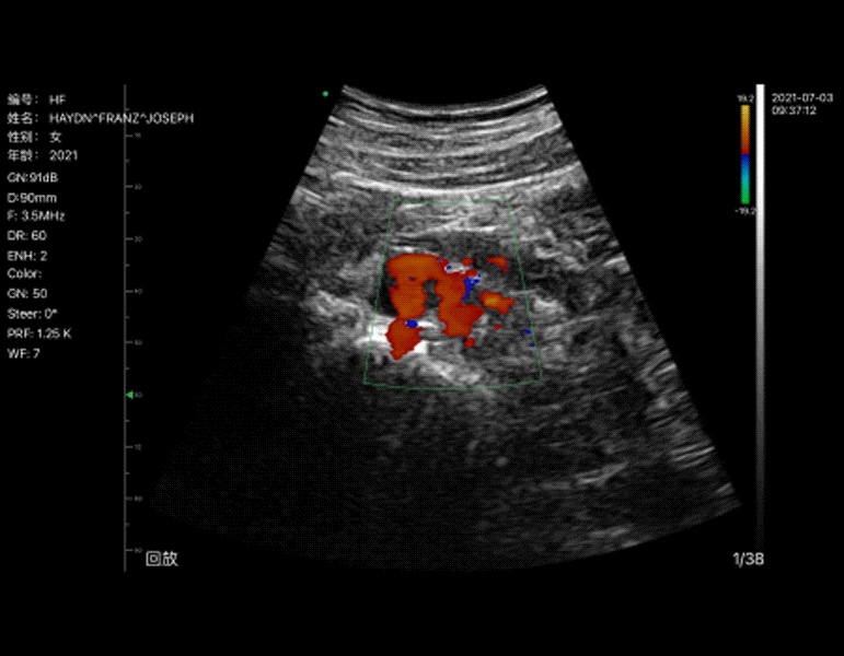 13-abdomen