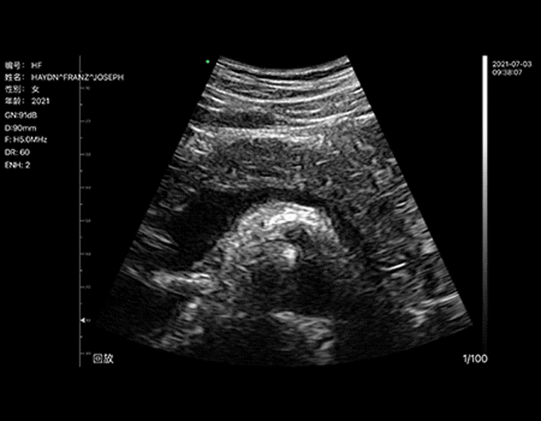 16-pancreas