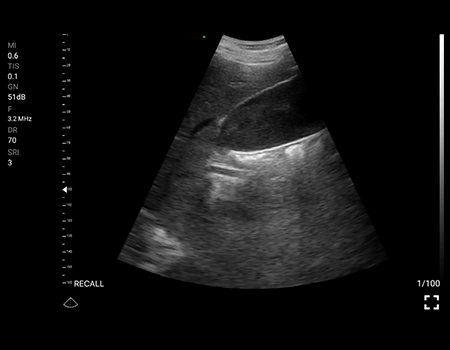 7-Gallbladder