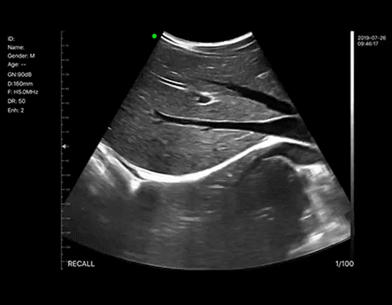 8-Liver