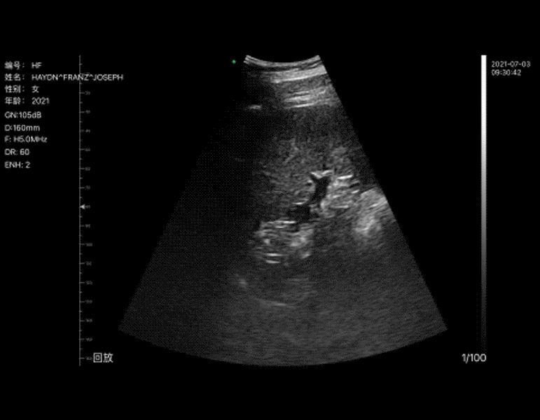 11-Spleen