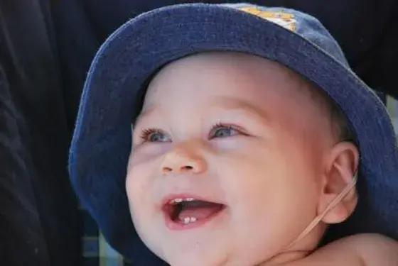 Is Your Baby Teething Know The Signs and Soothing Tips