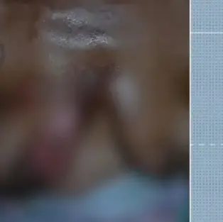 Veja depoimento de mulher vítima de violência doméstica em Mata Grande: "jogou a frigideira em mim"