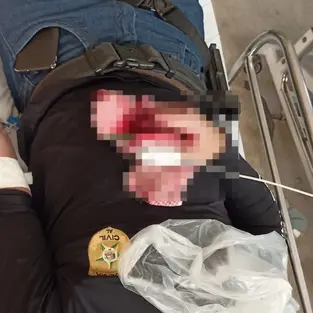 Policial é baleado durante confronto com suspeito de mandar matar o pai e comemorar crime em Senador Rui Palmeira