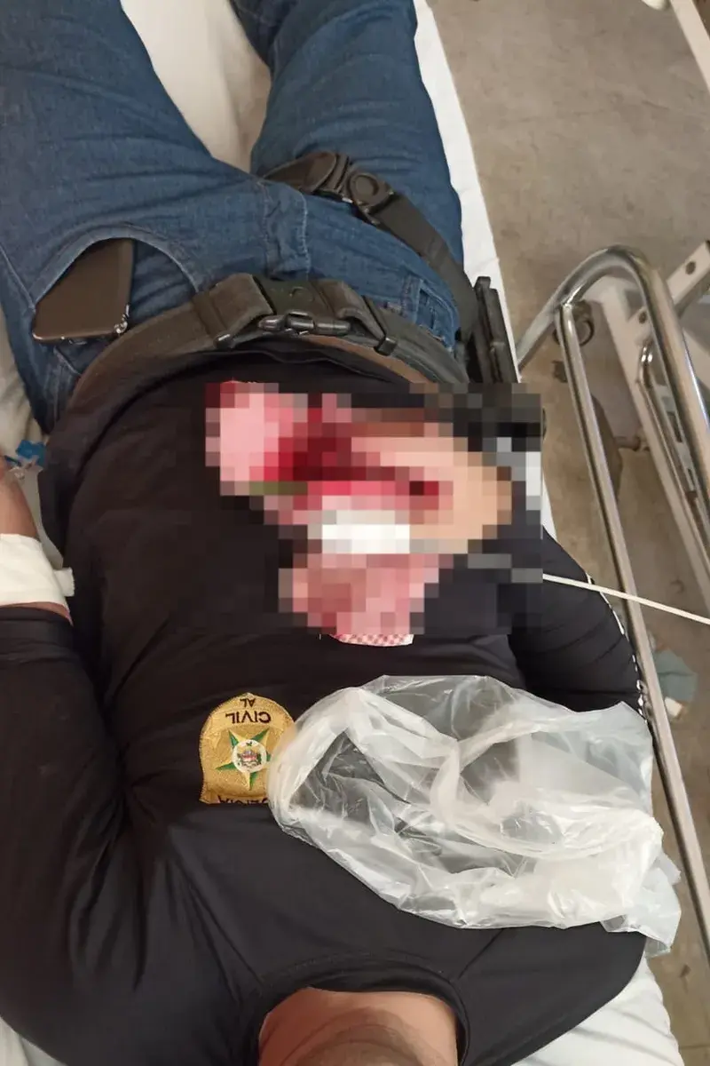 Policial é baleado durante confronto com suspeito de mandar matar o pai e comemorar crime em Senador Rui Palmeira