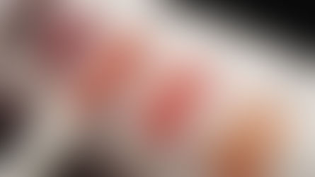 ¿Cómo saber si tienes las cetonas altas?