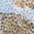 Those spots!