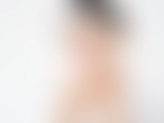 敏感肌でも安心？メンズ脱毛で肌荒れしないためのポイント5選