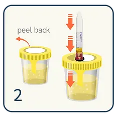 UTI urine collection step 2.webp