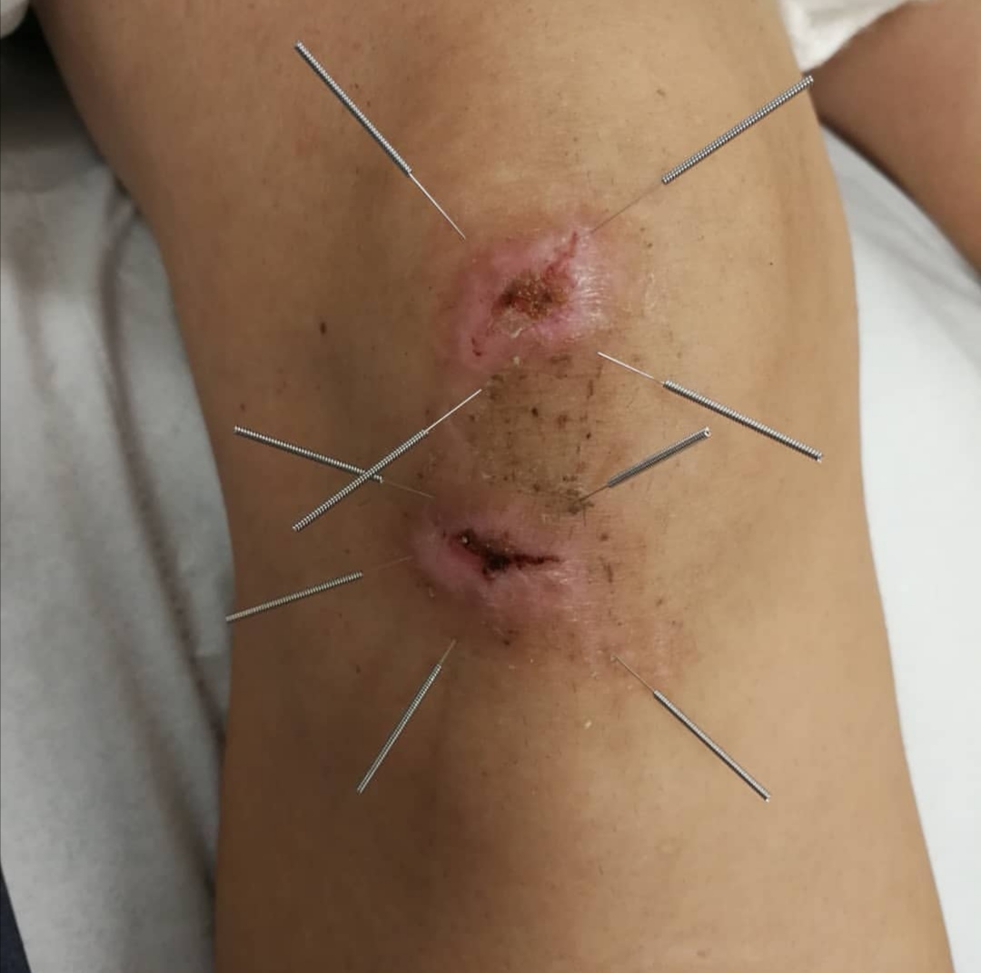 not suitable for massage just yet...
