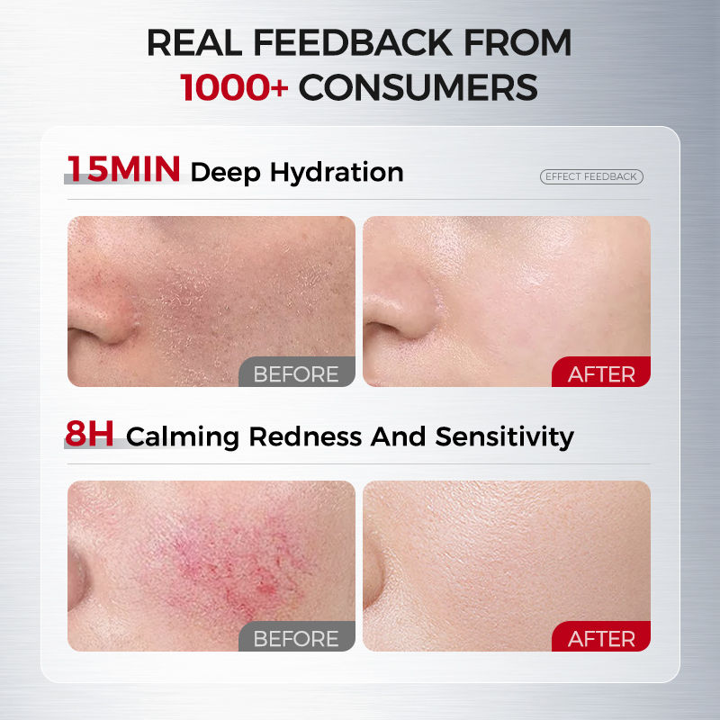 Thumbnail: Hydrating & Soothing Toner, Lotion & Cream with 8D Hyaluronic Acid & Ceramides �