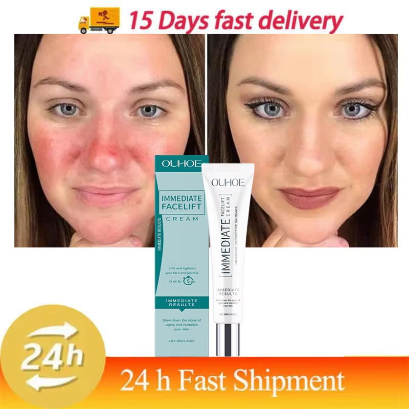 Thumbnail: Facial Redness Repair Cream Improve Sensitive Skin Dryness Moisturizer Hydrating