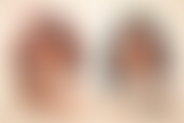 Gevoelige huid: zo verzorg je haar zonder haar uit balans te brengen