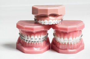 Braces