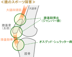 hiza02.gif