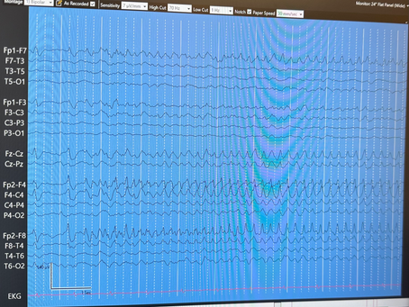 Example of gradual increase of sz