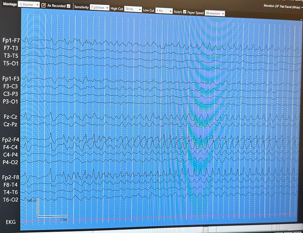 Example of gradual increase of sz