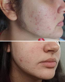 Consultoria de skincare