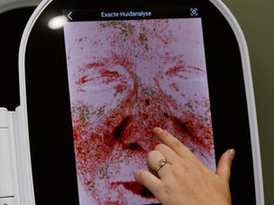 Waarom een professionele huidanalyse essentieel is voor skin longevity