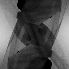 ERWIN B IMG BLEND 4.jpg