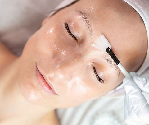 kemisk peeling website.jpg