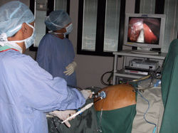 Gallbladder disection using SILS port