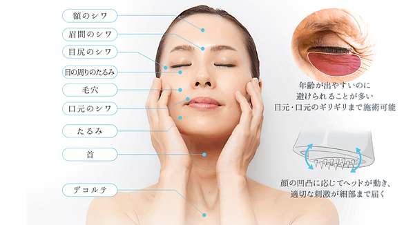 エイジングサインと特徴(ウェブ用).png