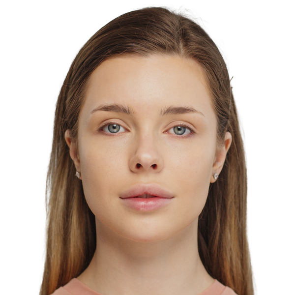 RF Microneedling treatment for skin rejuvenation and acne scar reduction