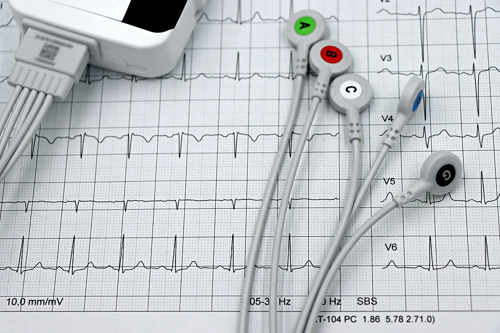 ECG printout with gray leads and color-coded electrode clips labeled A, B, C, D, and G on a heart rhythm chart.