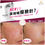 縮圖：美國 Protop Pro-Skin Booster 速效瘦面針