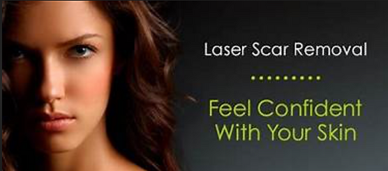 Painless Laser Scar Removal