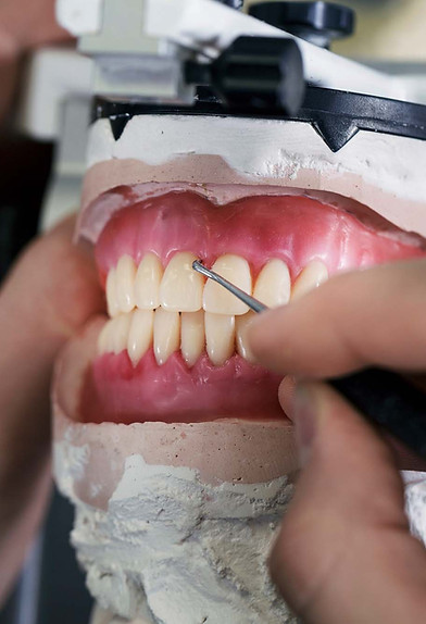 tandtechnicus maakt uitneembare gebitsprothese