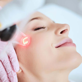 Laserbehandeling