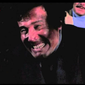 Getting Your Balls Squeezed Can Kill You in Many Ways, Says Science